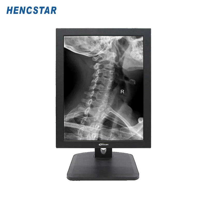 21.3 Inch 3M Medical Monitor